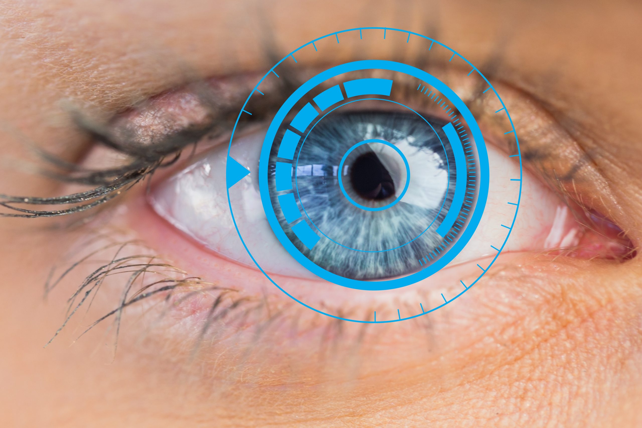 LASIK vs ICL: Best Eye Surgery? | ASMII